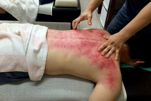 Tratamento das costas com Gua Sha